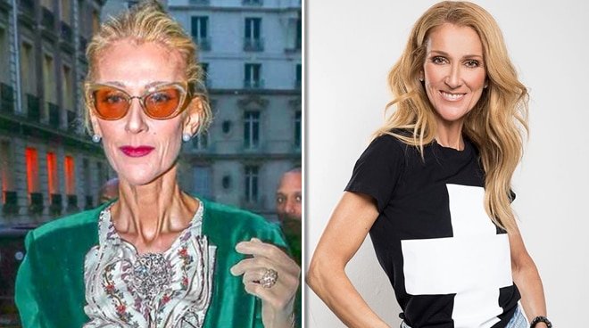 Does Celine Dion Have An Eating Disorder - Aaron Easton's Blog